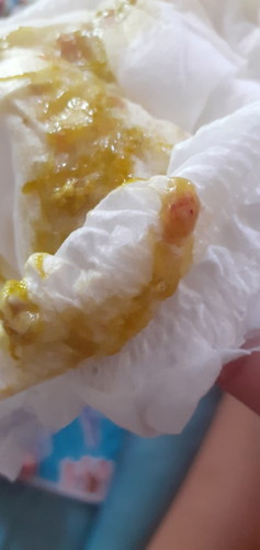 ใช่มูกเลือดรึป่าวคะ