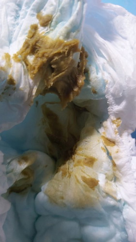 Poop every after feeding