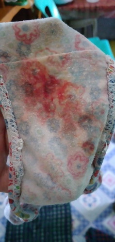 2cm kanina umaga 7am