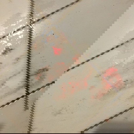 อ้วกเป็นเลือดอัตรายไหมคะ