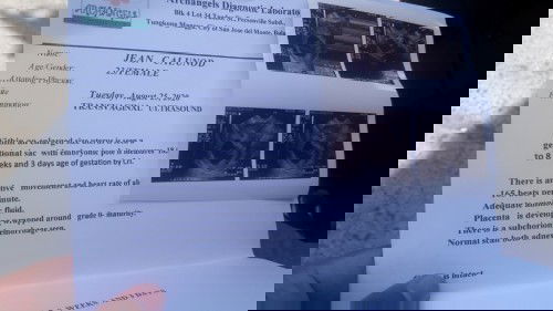 Mga mommy ok po ba c baby sa loob kakakuha ko lang ng result ko