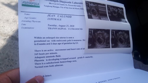 Mga mommy ok po ba c baby sa loob kakakuha ko lang ng result ko