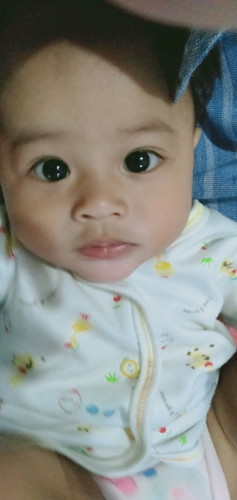 Kulit belang