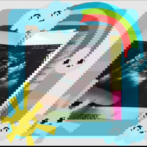 ลูกชายดิ้นเก่งมาก. คุณหมอชมเลยว่าน้องจะต้องแข็งแรงมากแน่ๆเลย