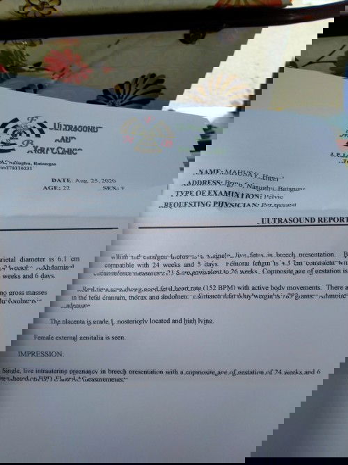 Ultrasound @ 24 weeks