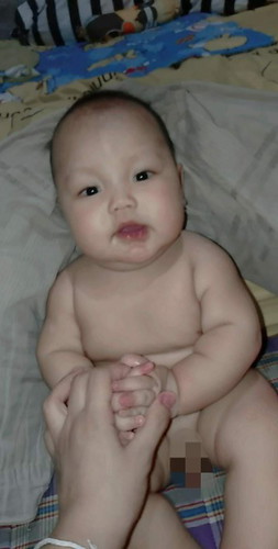 อาหารเสริม