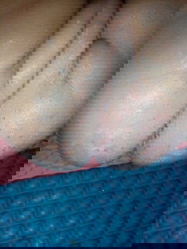 Best treatment for baby rashes