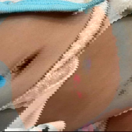 ลูกสาวเป็นอะไรก็ไม่รู้ค่ะ