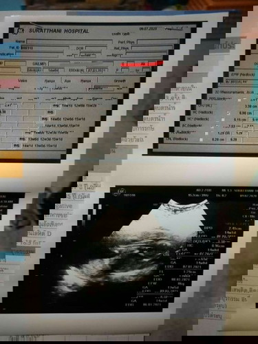 14สัปดาห์ รู้เพศรือยังค่ะ