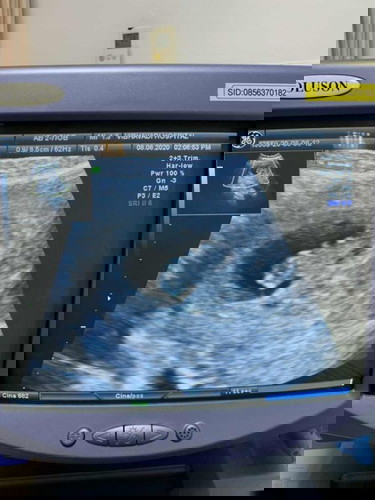 ถั่วเขียวน้อยมารายงานตัวจ้าา 💚