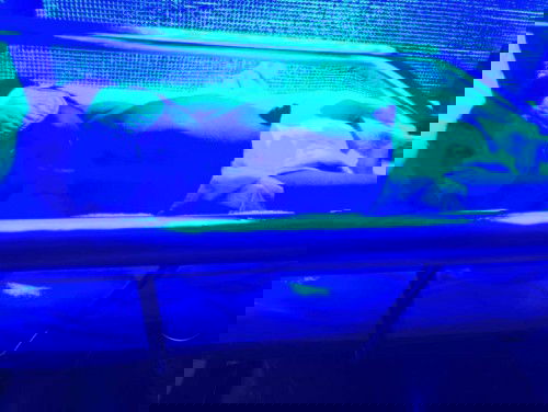 เด็กทารกได้อบตัวเหลือง