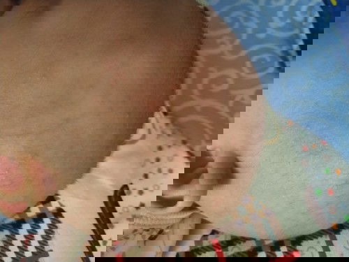 Biang keringat di kepala