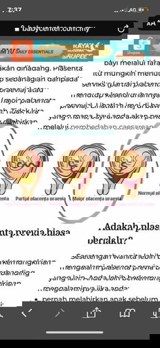 Plasenta previa/uri kat bawah
