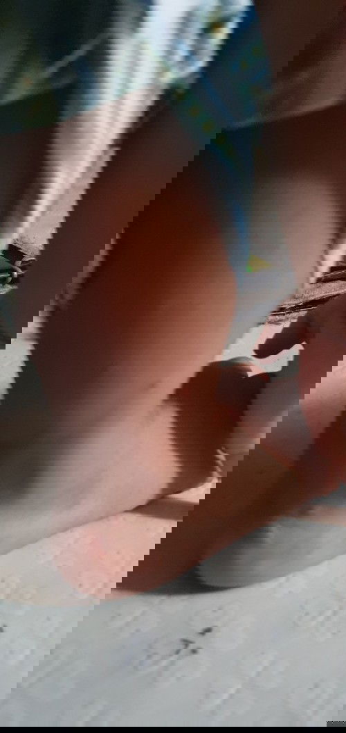 Kati-kati sa balat ni baby