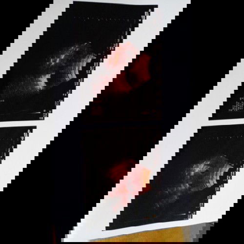 Usg 6 minggu belum ada terlihat janin, normalkah??