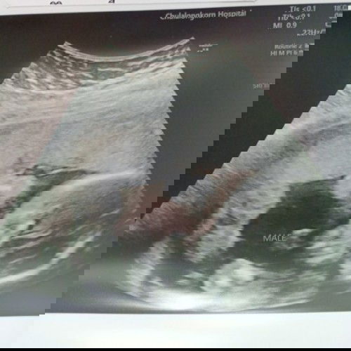 กำหนดคลอด28 ธันวาค่ะ ท้องแรกของแม่