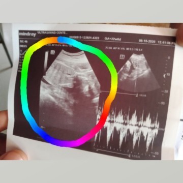 24weeks FTM
