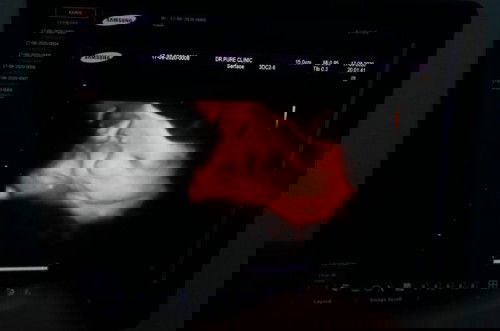 ลูกบ่าวอิแม่