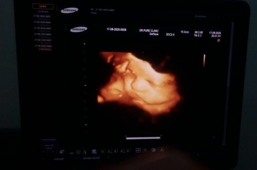 ลูกบ่าวอิแม่