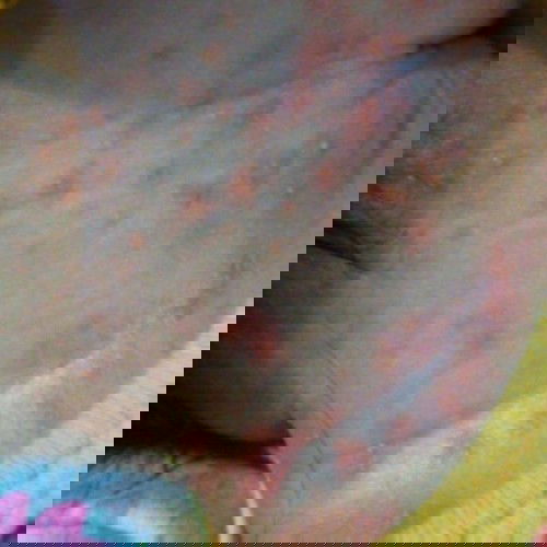 biang keringat kah? solusinyabun