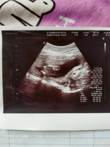 อยากรู้เพศลูก