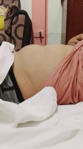 Bump or bilbil?
