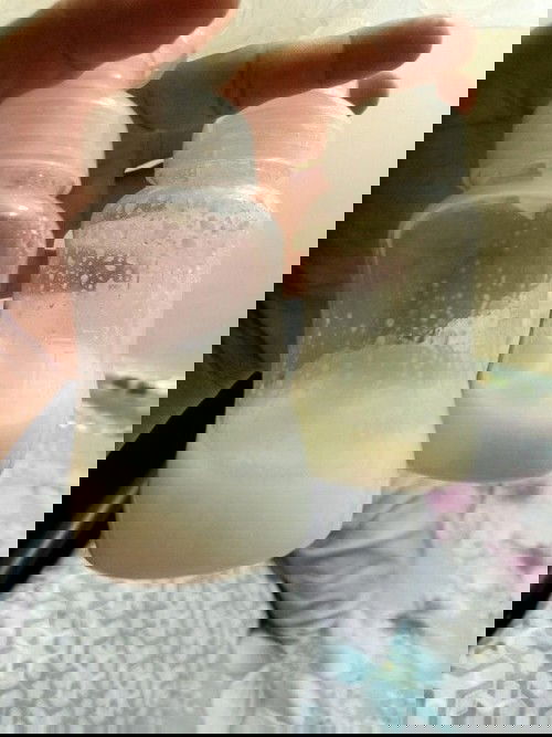 Hello. Normal lang po ba na hindi parehas ang kulay ng breastmilk? Please see photo below. Thankyou.