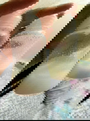 Hello. Normal lang po ba na hindi parehas ang kulay ng breastmilk? Please see photo below. Thankyou.