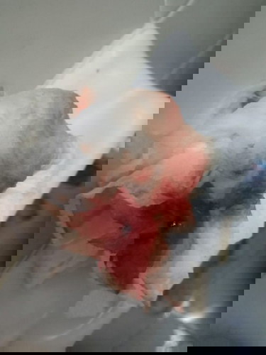 ตรวจปากมดลูกวันนี้และตอนเย็นมีมูกเลือด