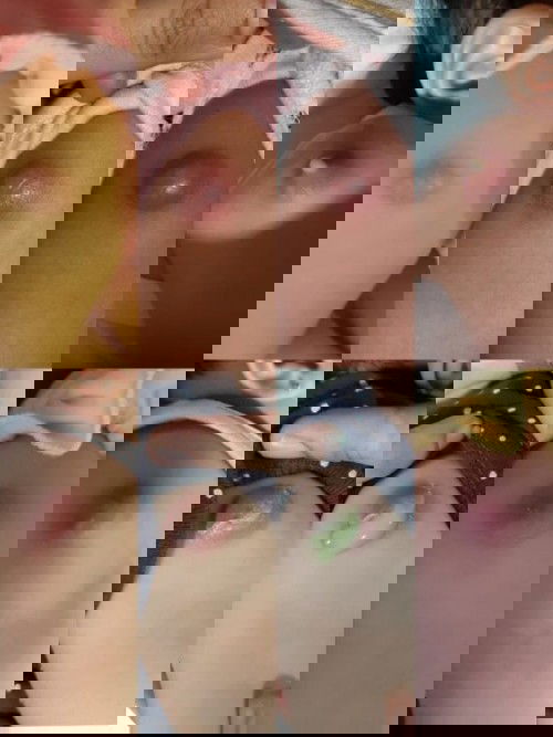 Penyembuhan Luka Nanah Bisul BCG