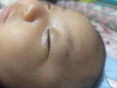Maliit na bilog sa mukha ni baby