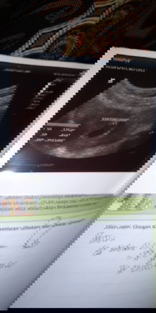 Ada yang HPL bulan Desember?