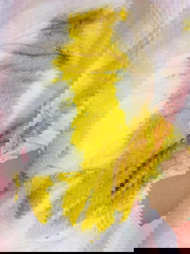 Poop, teething or Diarrhea