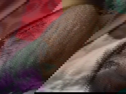 Masalah kulit bayi baru lahir