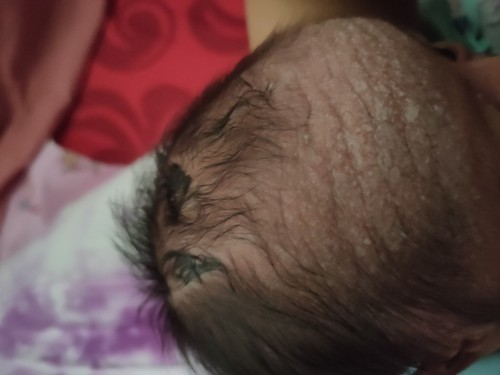 Masalah kulit bayi baru lahir
