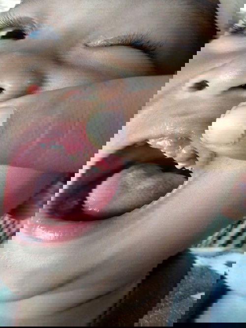 ลูกเป็นอะไรในปากไม่ทราบค่ะ