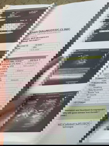 6 months breech position