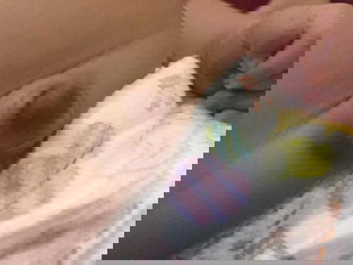 น้องได้1เดือน20วันสะดือนูน