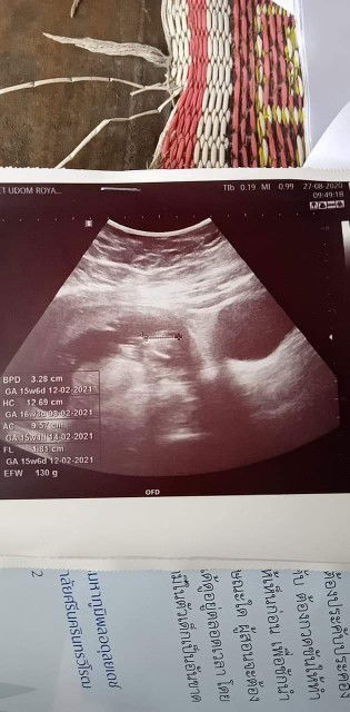 รูปน้องอยู่ตรงไหนค่ะ ท้องแม่หนามาก