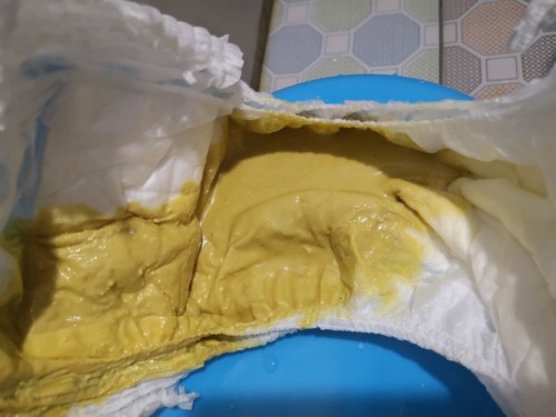 Yellow Poops