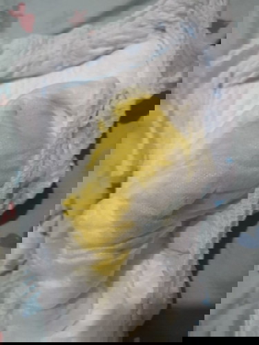 Yellow poops