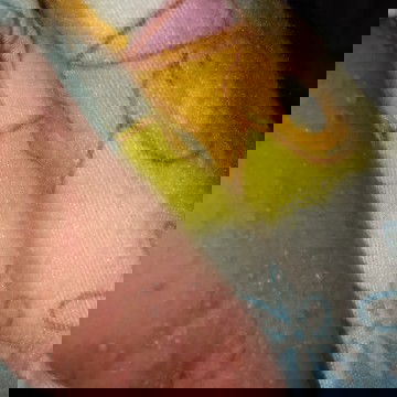 saraf pada bayi baru lahir