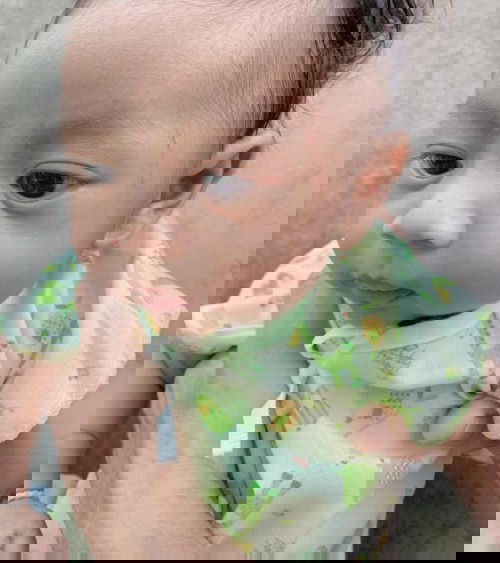 ลูกชอบข่วนหน้าตัวเอง😂