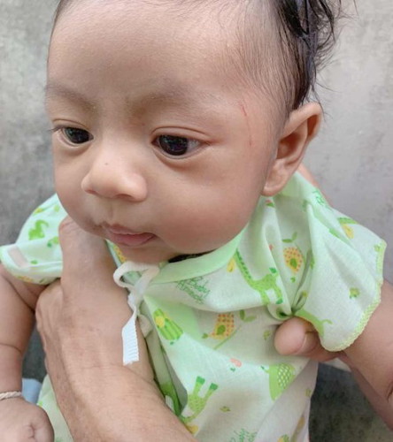 ลูกชอบข่วนหน้าตัวเอง😂