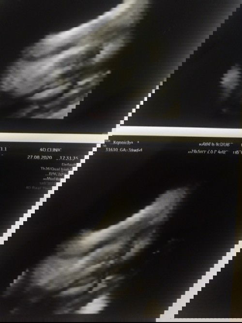 เจ้าอ้วนแก้มย้อย