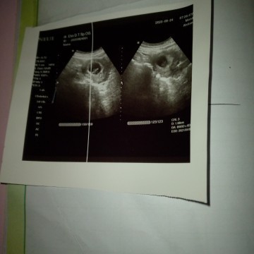 Apakah foto itu benar sesuai umur kandungan ku 8 minggu