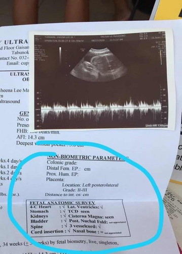 Fetal Anatomic Survey