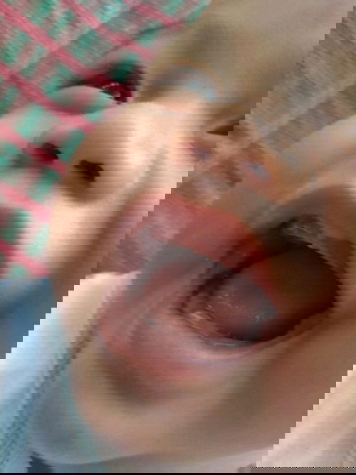 ฟันน้ำนม