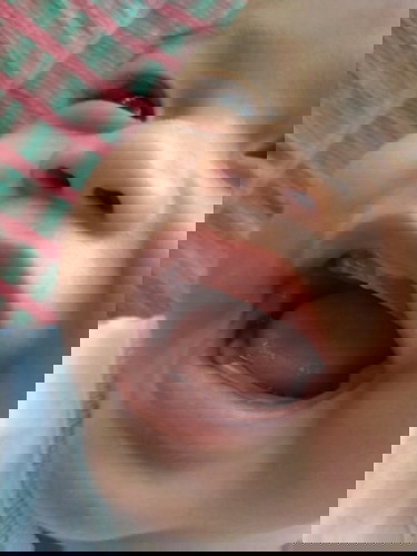 ฟันน้ำนม