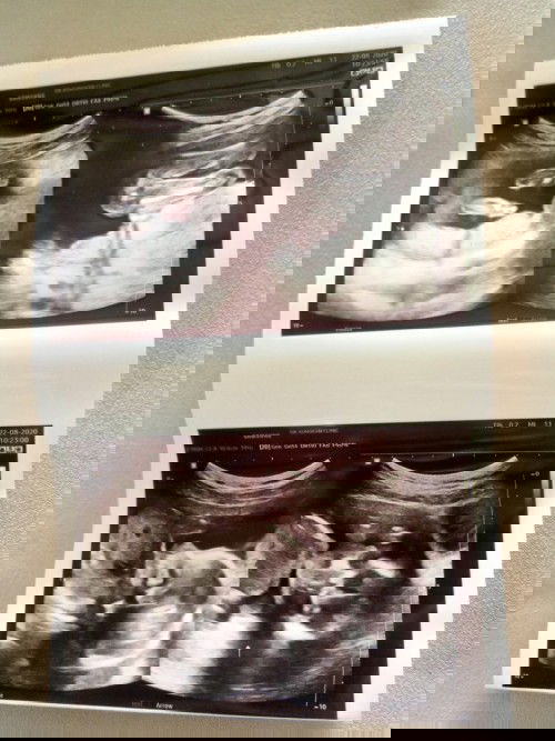 สอบถามแม่ๆค่ะแบบนี้น้องเป็นผู้ชายหรือผู้หญิงค่ะแม่บ้านนี้มองไม่ออกน้อง